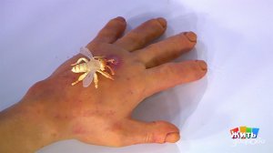 Укус осы - опасные последствия. Жить здорово! Фрагмент выпуска от 27.04.2018