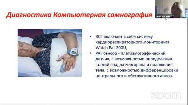 Синдром ночного обструктивного апноэ