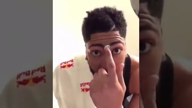 Anthony Davis Shaves His Unibrow!