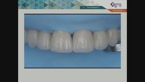 Камиль Хабиев - Лайфхаки в реставрации зубов