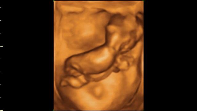 Eko fetale 4D java 12 e shtatzanise (12 weeks human embryo on 4D Ultrasound) смотреть онлайн