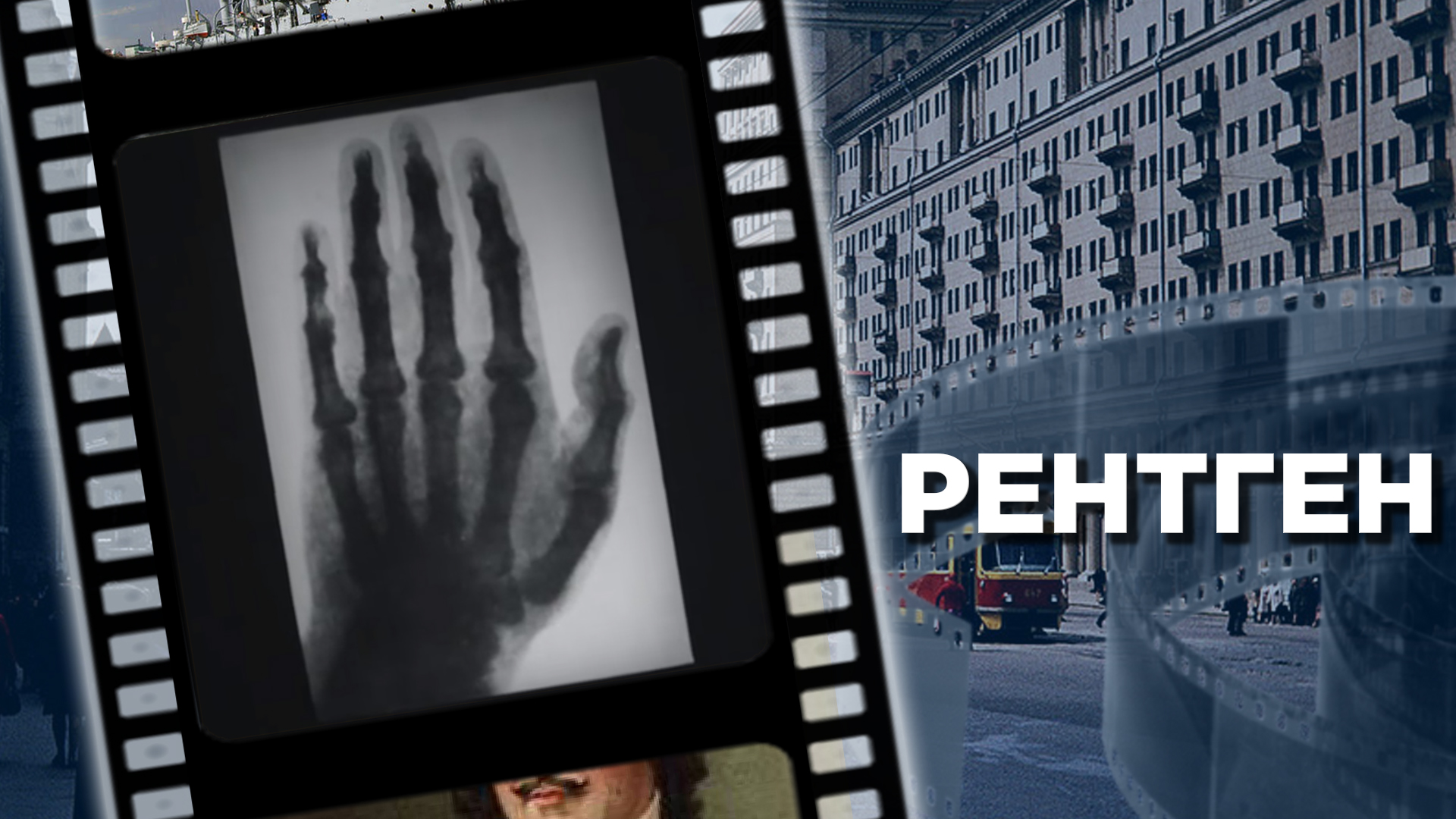 Рентгеновское излучение