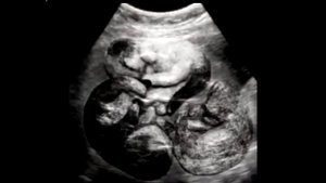 Кошку привезли на усыпление. Но когда ветеринар осмотрел её, он выгнал хозяев из клиники...