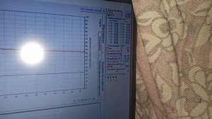 не переключается на газ не пищит