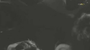 Ансамбль "Мелодия" - Хали-гали