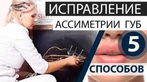 5 способов ИСПРАВЛЕНИЯ ассиметрии губ