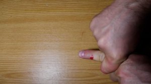 КРОВОТЕЧЕНИЕ ИЗ ПАЛЬЦА. Как остановить, если нечем перевязать. Смывать ли кровь водой