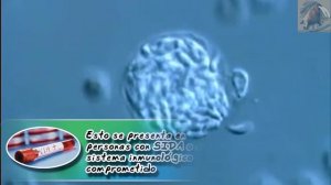 Toxoplasmosis |¿Es necesario deshacerse de tu gato en el embarazo?| |Enfermedades de los animales|