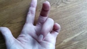 Биодинамика. Контрактура Дюпюитрена. Отзыв