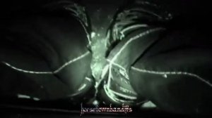 E5C4PE EDIT - FREDDIE DREDD KNOT MYSELF