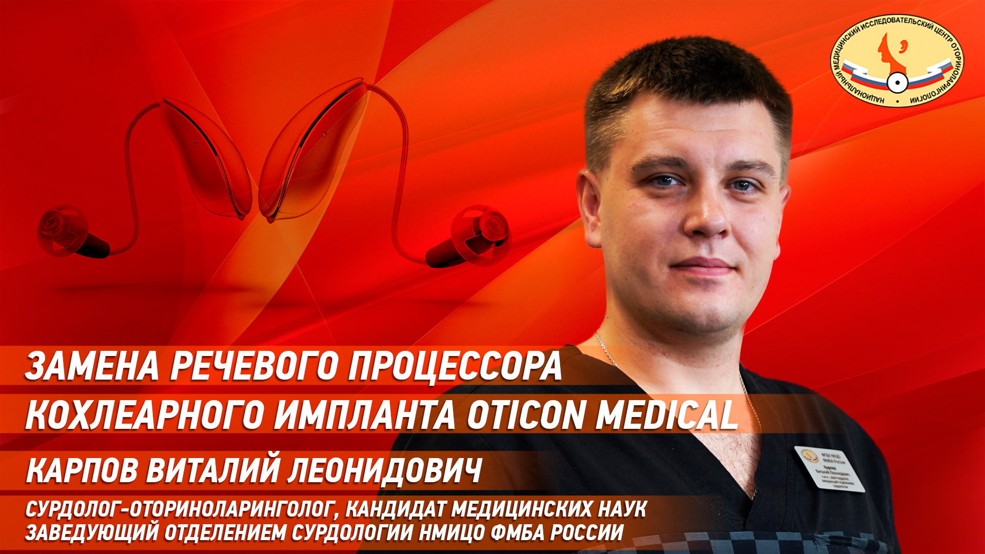 Замена речевого процессора кохлеарного импланта Oticon Medical