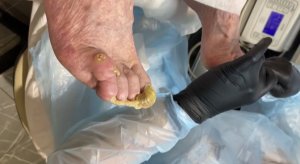 Обработка сложных ногтей