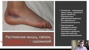 Первая помощь при ушибах, растяжениях, вывихах