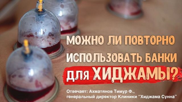 Можно ли повторно использовать банки для Хиджамы? | Ахматянов Тимур | II Конференция по хиджаме