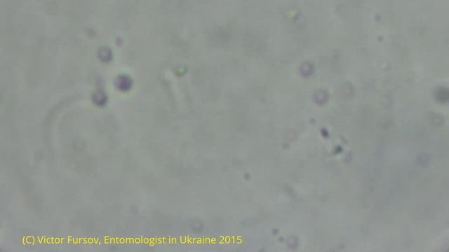 Под Микроскопом Цветочная Пыльца: Сирень, Жасмин, Тюльпан, Желтая Акация, Одуванчик.