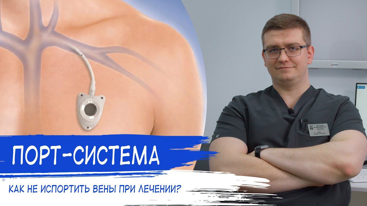 КАК НЕ ИСПОРТИТЬ ВЕНЫ ПРИ ХИМИОТЕРАПИИ? | ПОРТ-СИСТЕМА смотреть онлайн