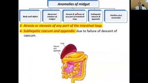 Midgut & hindgut (Revision 7)(Nutrition & GIT 7)