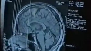 Наталья Бехтерева. Магия мозга-часть 5.