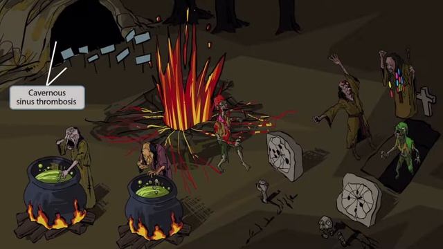 Mucor and Rhizopus for the USMLE Step 1 смотреть онлайн