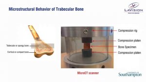 DVC – Mechanical behavior of biomaterials