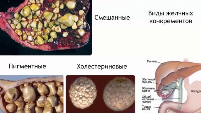 Польза ячневой крупы  только научные факты и исследования