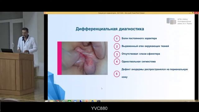 Анальная трещина