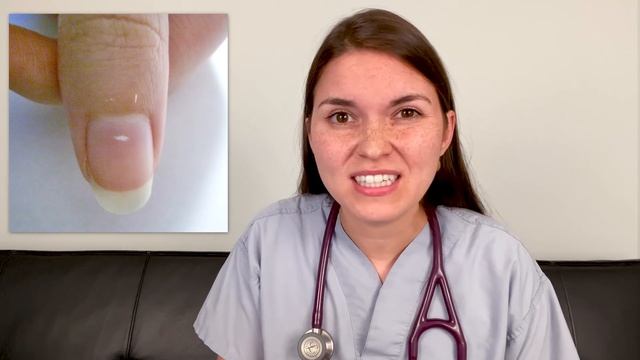 Doctor Explains what your NAILS say about your HEALTH: Top 10 Nail Problems смотреть онлайн