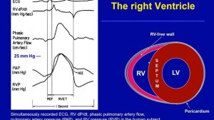 The right ventricle and heart-lung interaction Marco Maggiorini