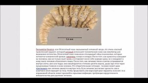 10 ОПАСНЕЙШИХ ПАРАЗИТОВ ЧЕРВЕЙ ДЛЯ ЧЕЛОВЕКА И НЕ ТОЛЬКО