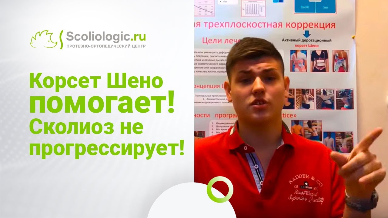 Корсет Шено. История восстановления подростка (сколиоз 3-ей степени) на протяжении 7 лет