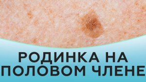 Родинка на половом члене