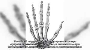 Рентген лучезапястного сустава в Москве