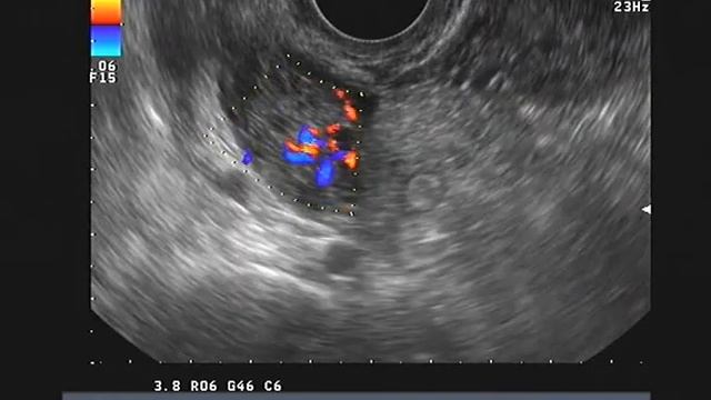 КРЯ832 смотреть онлайн