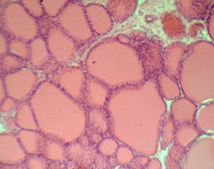 Железистый эпителий