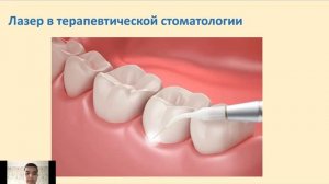 ЛЕЧЕНИЕ С ПОМОЩЬЮ ЛАЗЕРА В СТОМАТОЛОГИИ
