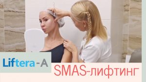 СМАС-лифтинг: как проходит процедура, до и после