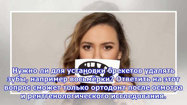 Выравнивание зубов: как не потратить время и деньги зря смотреть онлайн