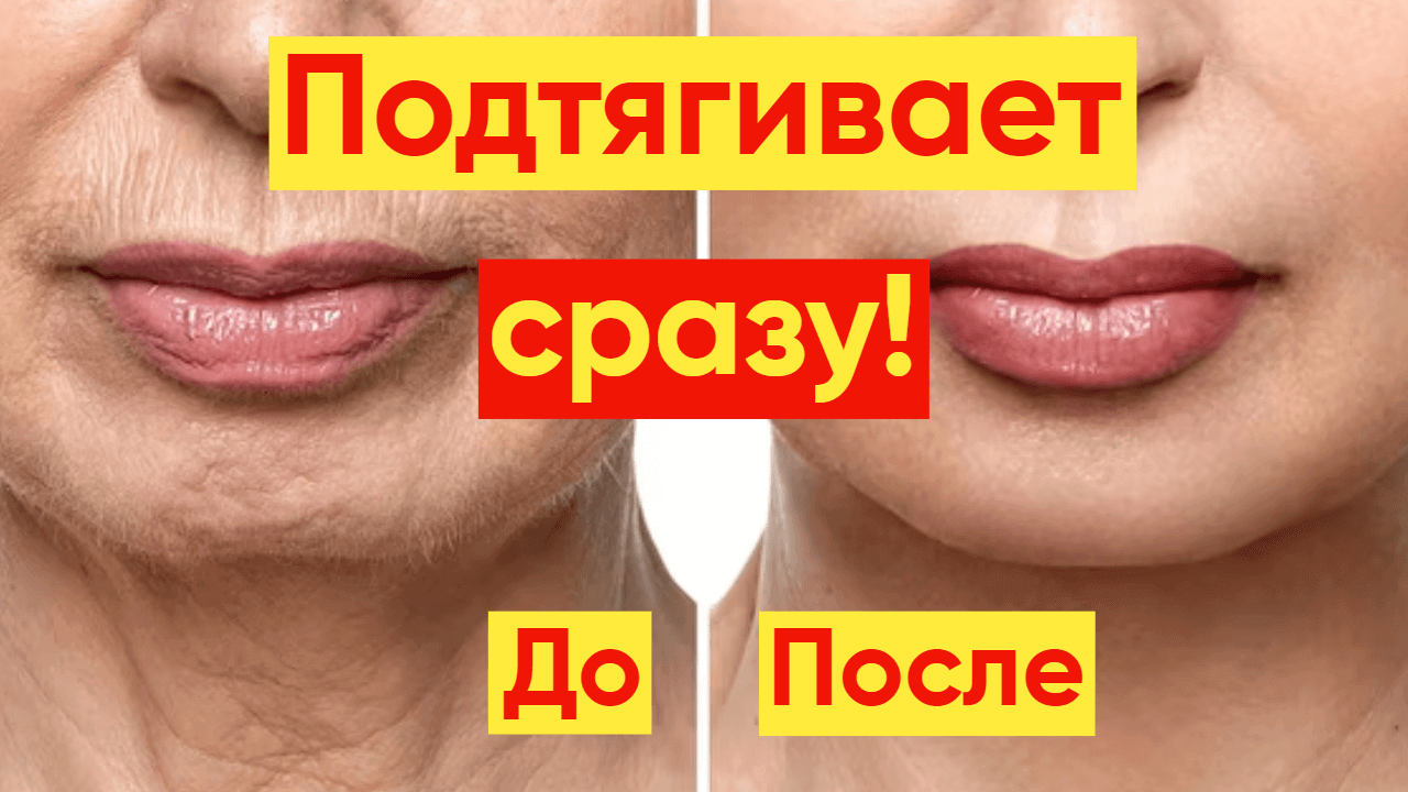 СПАСЕТ ОТ МОРЩИН И ДРЯБЛОСТИ  КОЖИ!