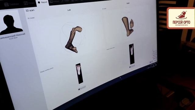 Прием ортопеда и заказ индивидуальной ортопедической обуви для больных ДЦП
