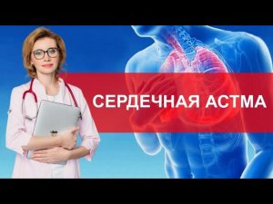 Сердечная астма. Что важно знать?