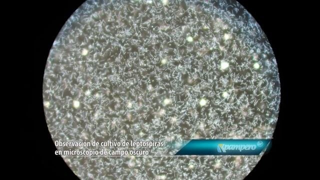 Leptospirosis