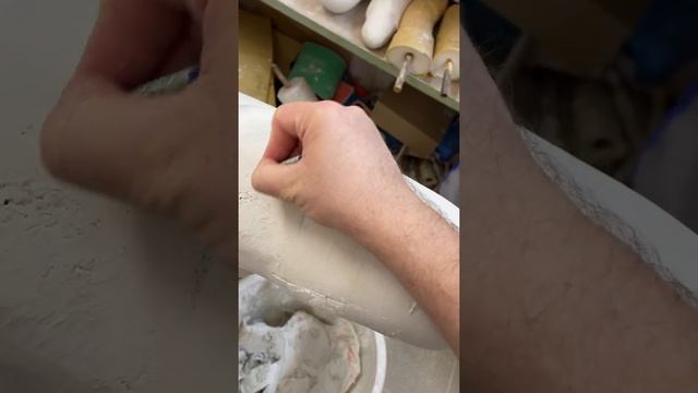 Изготовление протеза бедра Ossur Rheo knee
