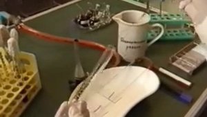 Изготовление мазков из мокроты или гноя.