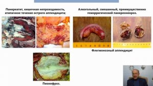 "Встречают по одежке": болезни костей и кожи. 24.04.20