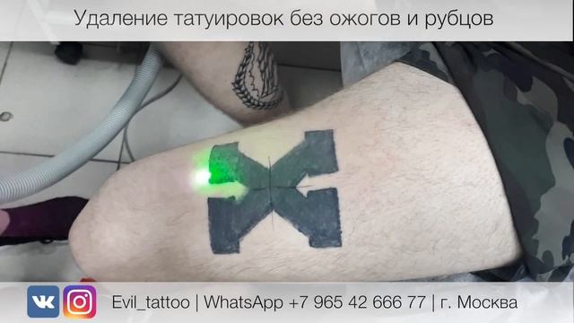 Лазерное удаление татуировки в студии Evil Tattoo. Без травм, ожогов и рубцов.