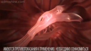 Реклама Нурофен Гель (2012-2013)