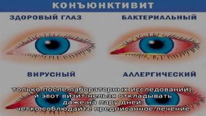 Советы для мам: что делать, если гноится глазик у новорожденного