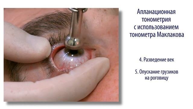 Тонометрия тонометром Маклакова проект «Электронный учебник»