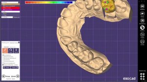 EXOCAD моделировка жевательных зубов