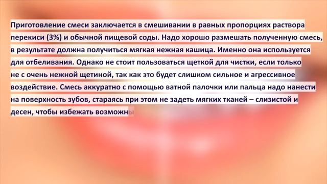 Отбеливание зубов в домашних условиях. Как не навредить себе перекисью водорода?